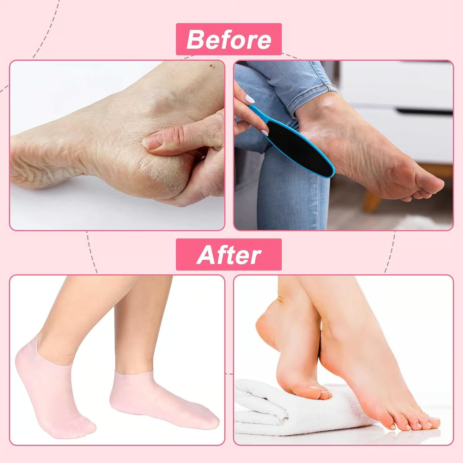 Moisturizing Jelly Socks for Dry Feet | Hydrating Gel Heel Socks for Cracked Heels, Rough Skin & Callus Repair