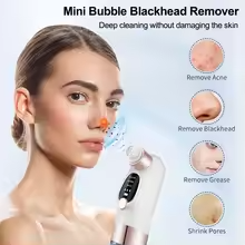 Micro Bubble Beauty Instrument Black & White Heads Remover